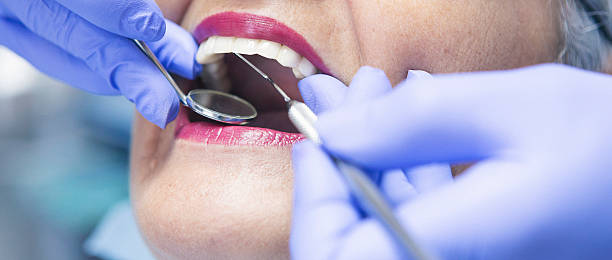 Best Emergency Broken Tooth Repair in Danville, IN